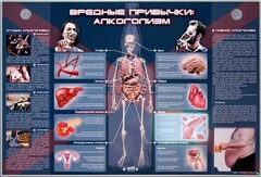 Электрифицированный стенд "Вредные привычки: алкоголизм" - fgospostavki.ru - Сочи